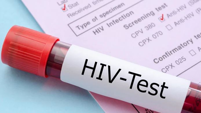 HIV IN PAKISTAN